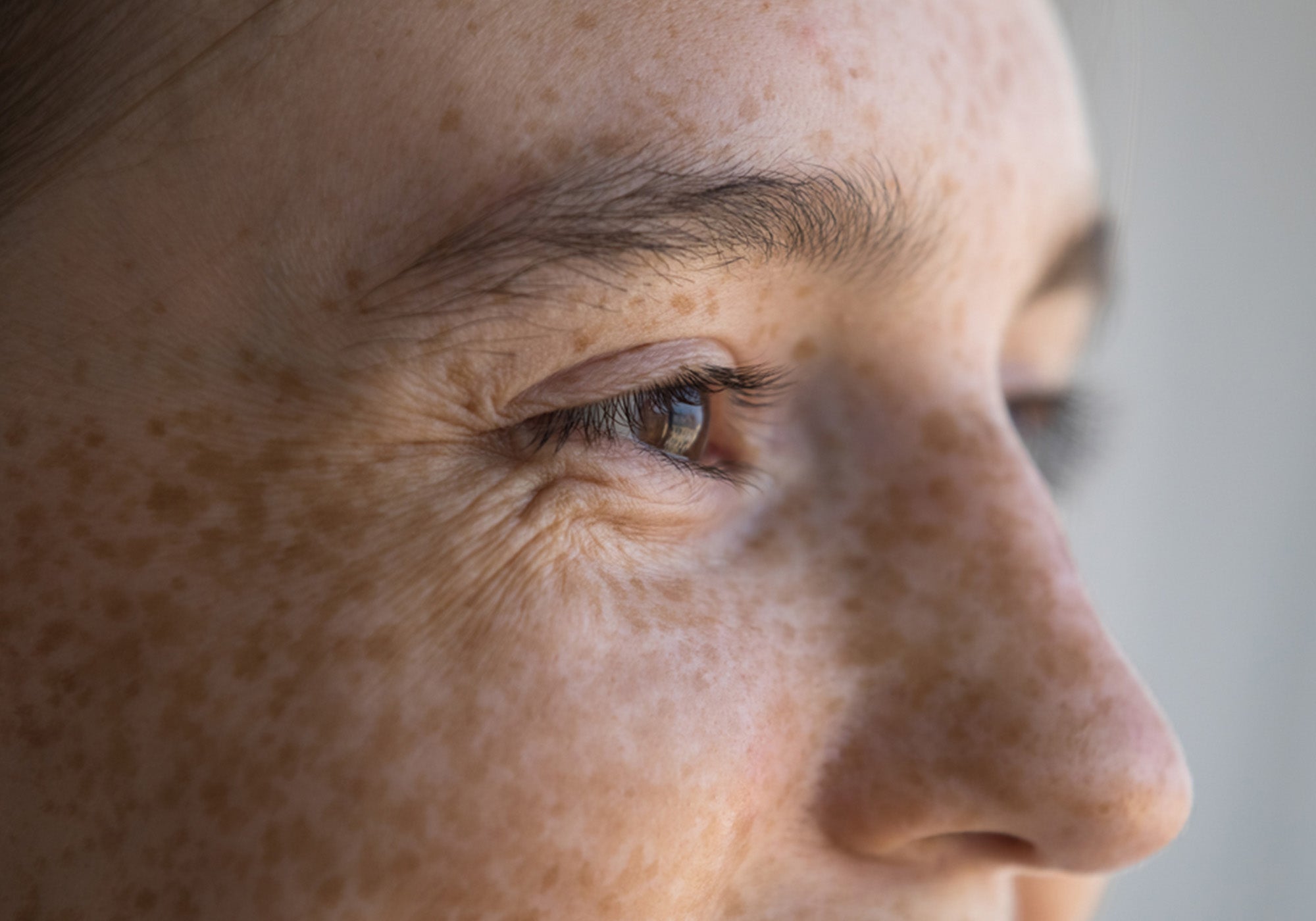 Nahaufnahme der Augenpartie einer Frau mit Sommersprossen